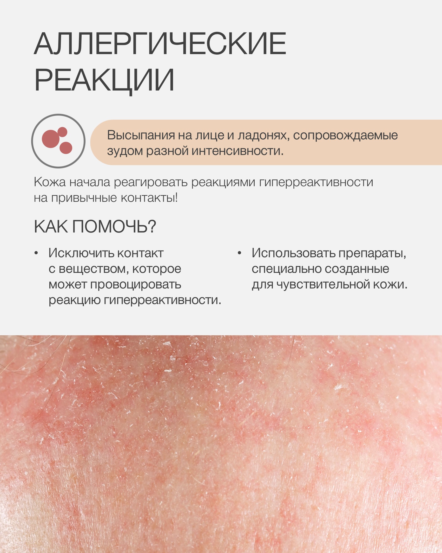 Пост ковид и кожа4.jpg Пост ковид и кожа4.jpg